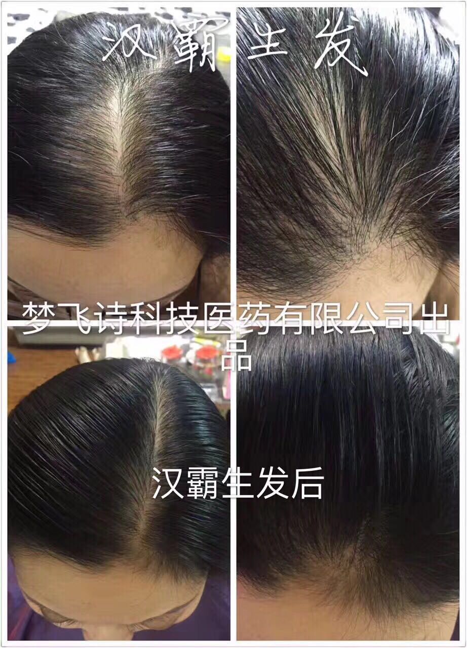 漢霸生發(fā)